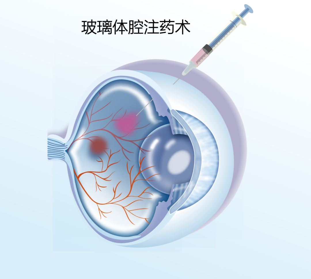 undefined 图片