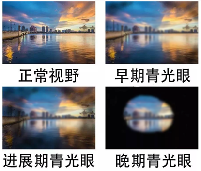4a43d01427b9da44454506d8ddf1eea2.png