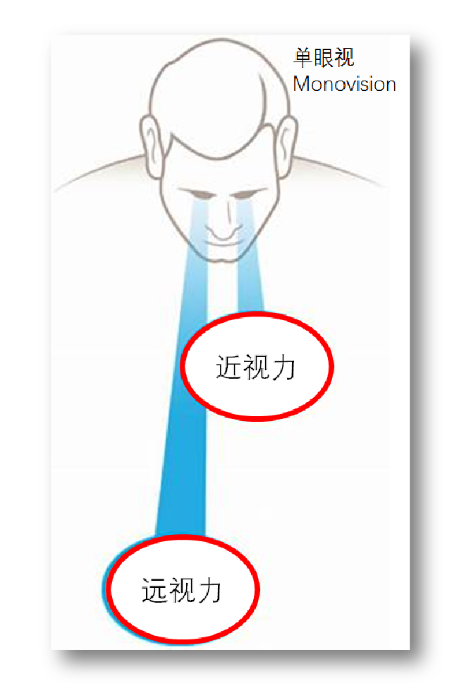 单眼视.png