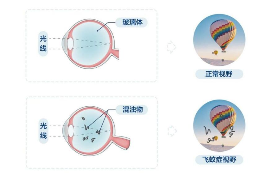 生理性.png